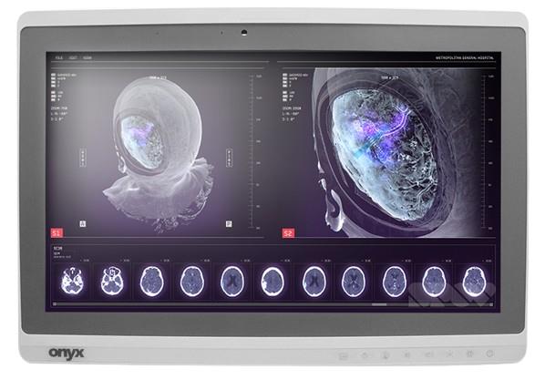 Onyx-Zeus-248 Professional Medical AIO i7-6500U/8GB/250GB SSD *TouchScreen* *No Stand* Onyx-Zeus-248 Professional Medical AIO i7-6500U/8GB/250GB SSD *TouchScreen* *No Stand*